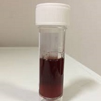 Dark colour urine
